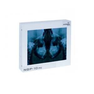 Negatoskop stomatologiczny Cefalom-01 240x300 mm